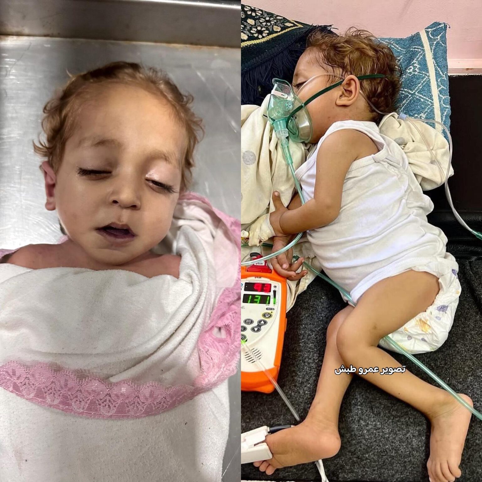 وفاة طفل من قطاع غزة نتيجة حرمانه من العلاج