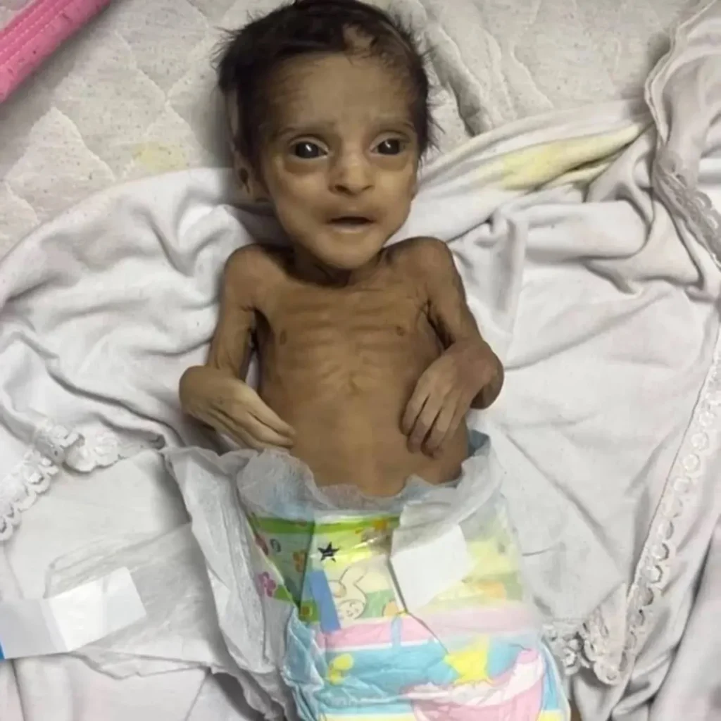 الأغذية العالمي: شخص من كل 3 بغزة لا يتناول الطعام أياما