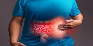 القولون العصبي… واسرار السيطرة عليه