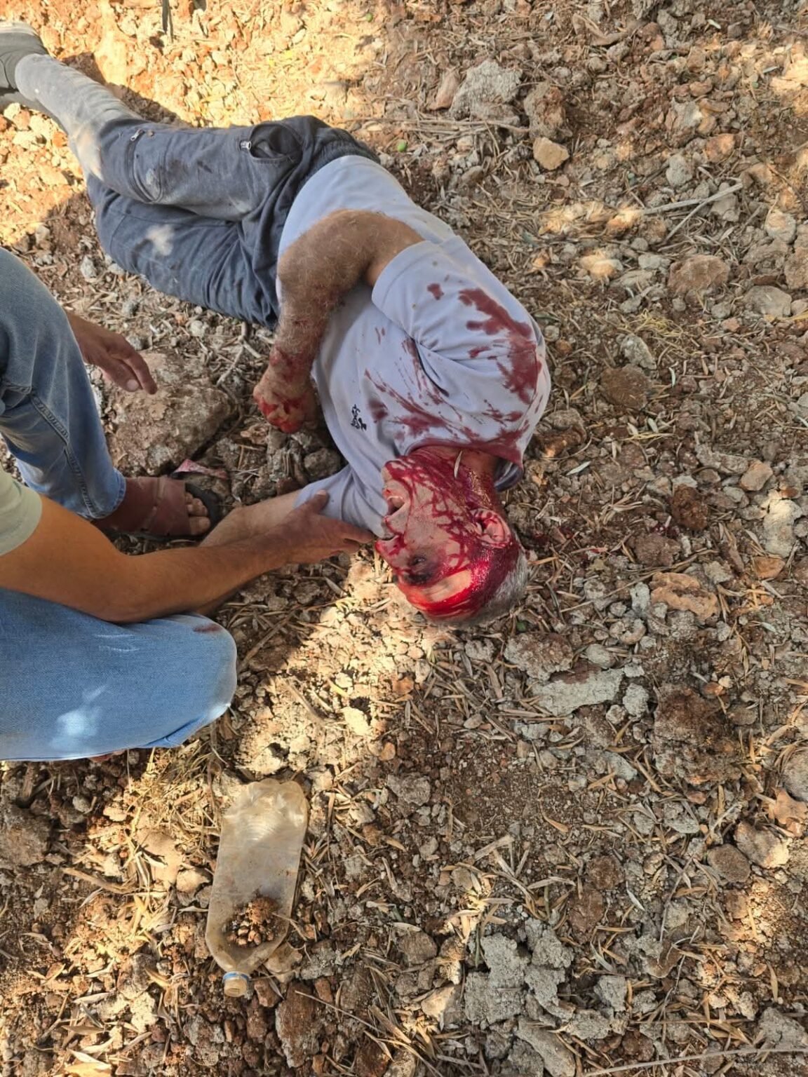 مستعمرون ارهابيون يهاجمون قرية أوصرين جنوب نابلس ويصيبون مواطنين بجروح
